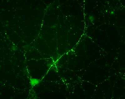 Immunohistochemistry: Synapsin I [p Ser549] Antibody [NB300-744]